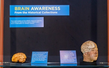 Brain Awareness From the Historical Collections