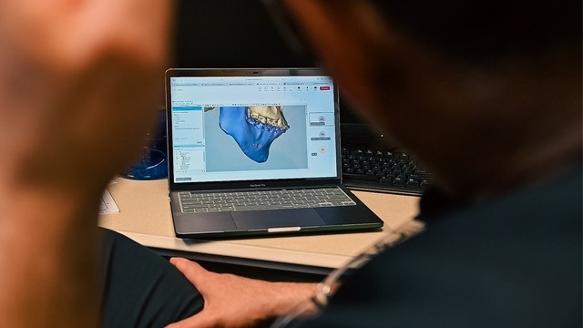 New Technology, Techniques Transform Oral Surgery
