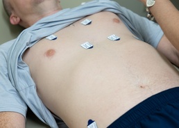 New ERASE Program Aims to Save Lives Through Early Cardiac Risk Detection