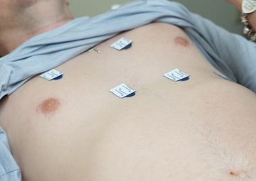 New ERASE Program Aims to Save Lives Through Early Cardiac Risk Detection