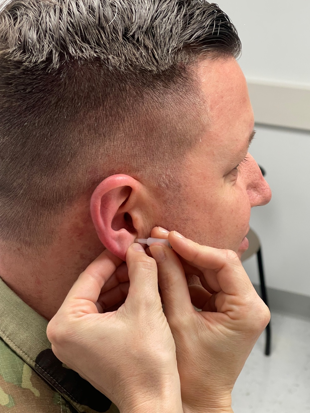 Battlefield Acupuncture