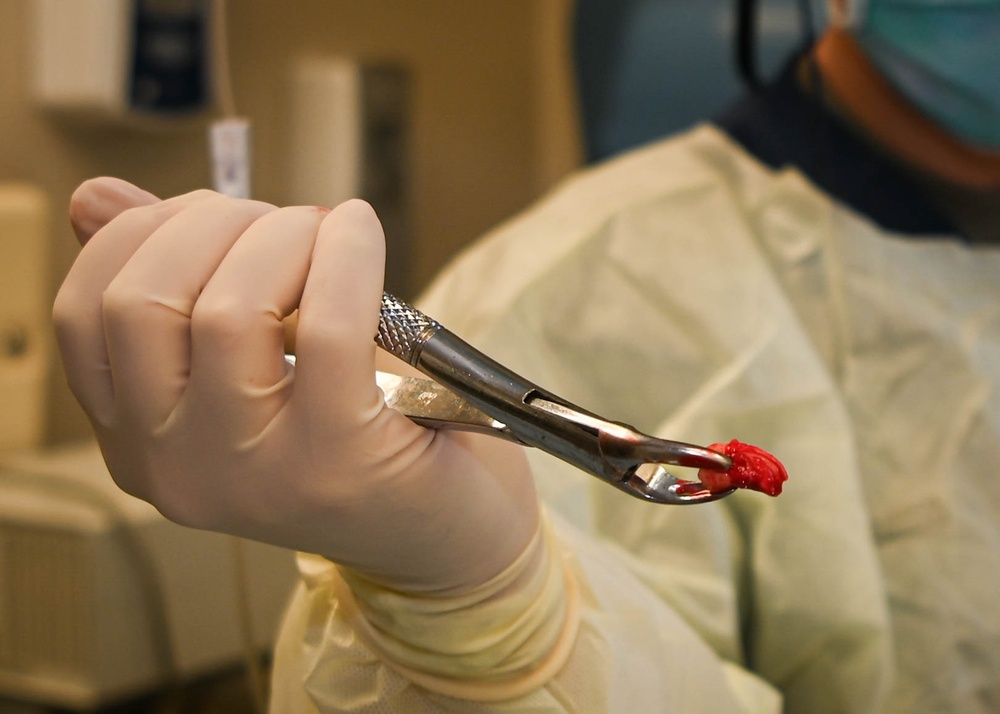 MDG cares for Offutt patients