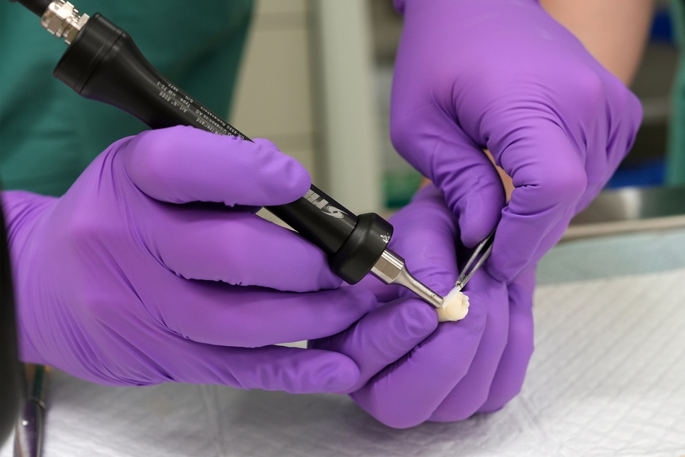 NAMRU San Antonio Researchers Collaborate for Novel Bone Fracture Fixation Technology
