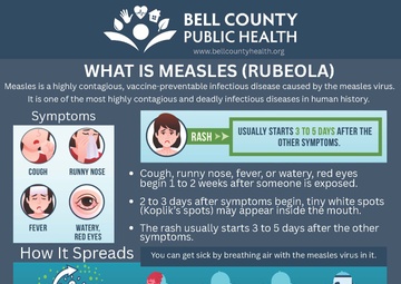 Fort Cavazos and CRDAMC Army Public Health urges vaccination for measles