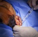 CP25 Surgeries aboard Comfort