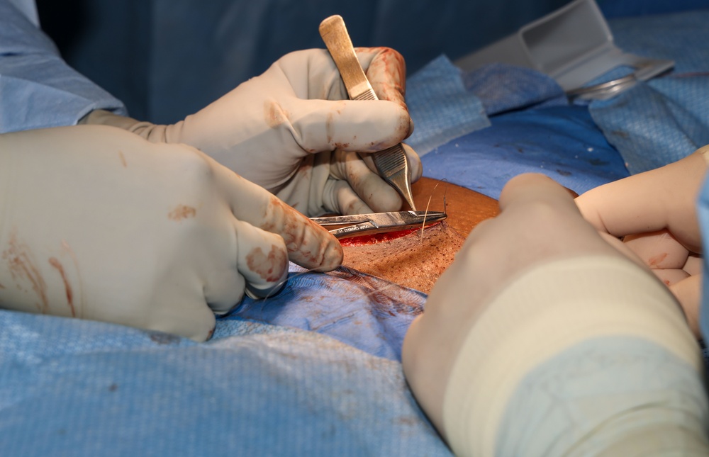 CP25 Surgeries aboard Comfort