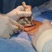 CP25 Surgeries aboard Comfort