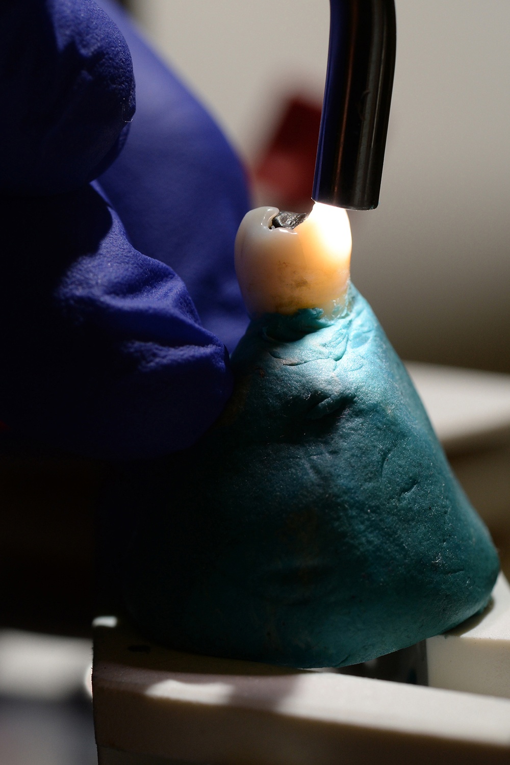 Navy Dentist Utilizes Advanced Technology to Detect Tooth Cracks
