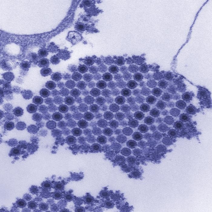 Chikungunya Virus Particles Revealed in Electron Micrograph