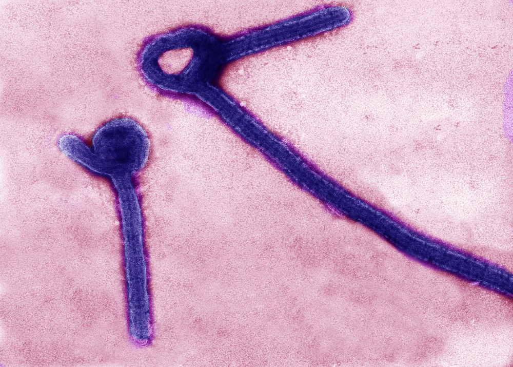Deadly Ebola Virus Particles Captured in Transmission Electron Micrograph