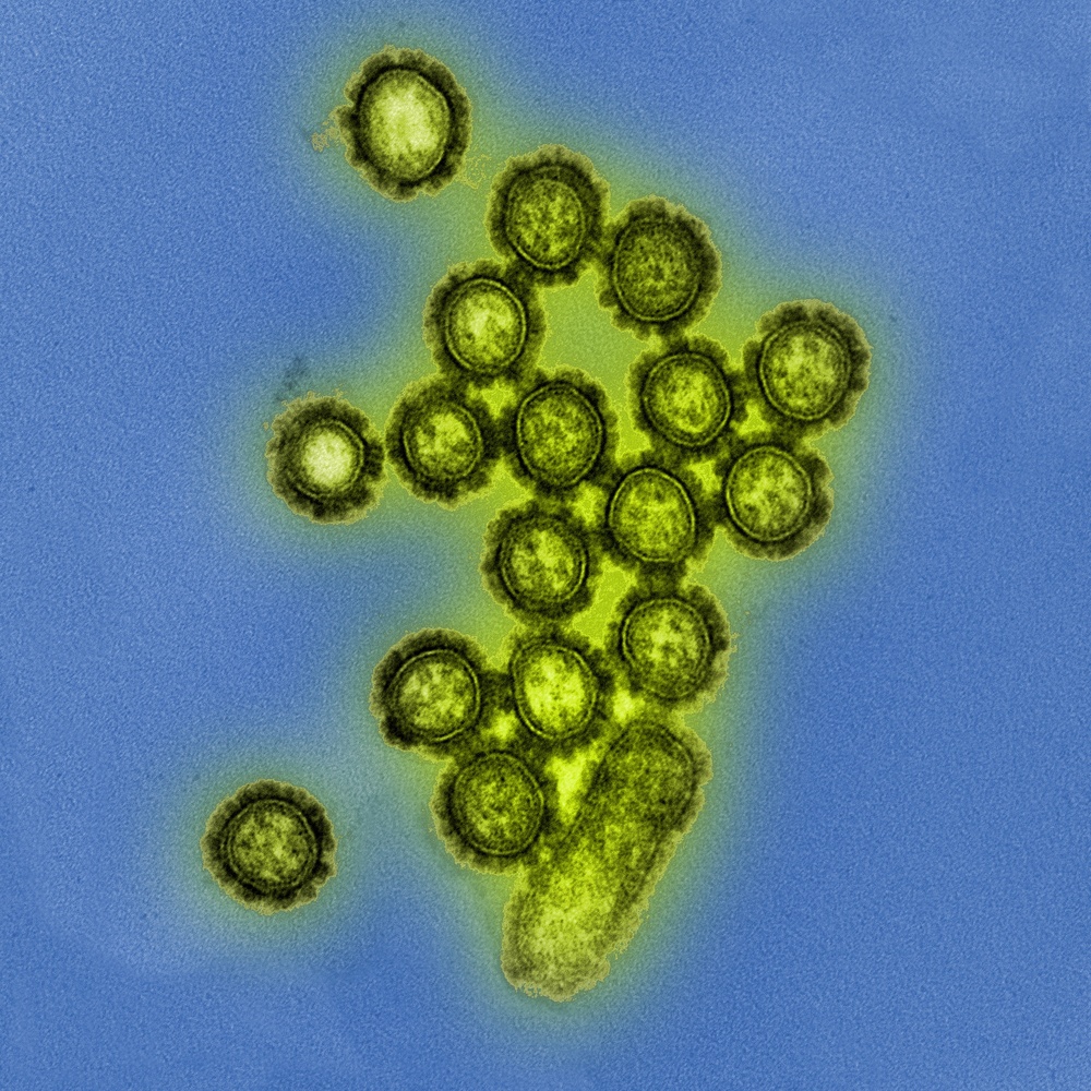 Microscopic View of H1N1 Influenza Virus Particles