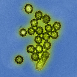 Microscopic View of H1N1 Influenza Virus Particles