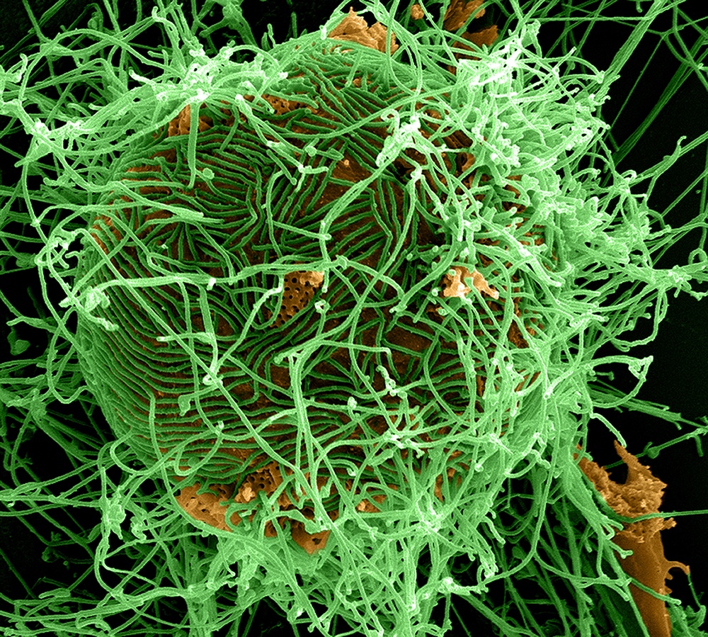 Ebola Virus Particles Bud from Infected Cell in Striking Micrograph