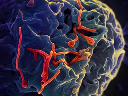 Ebola Virus Budding from Vero Cell Surface