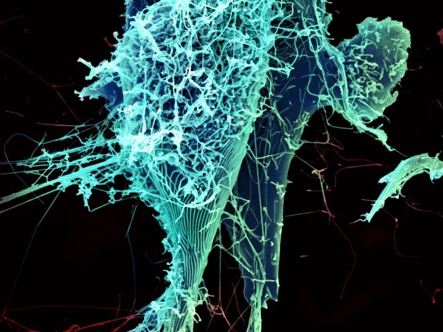 Ebola Virus Particles Shed from Infected Cell in Electron Micrograph