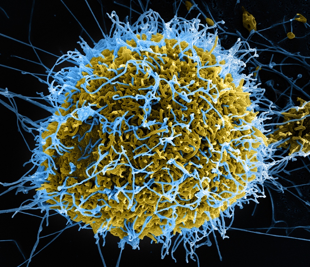 Ebola Virus Particles Bud from Infected Cell in Colorized Micrograph