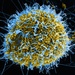 Ebola Virus Particles Bud from Infected Cell in Colorized Micrograph