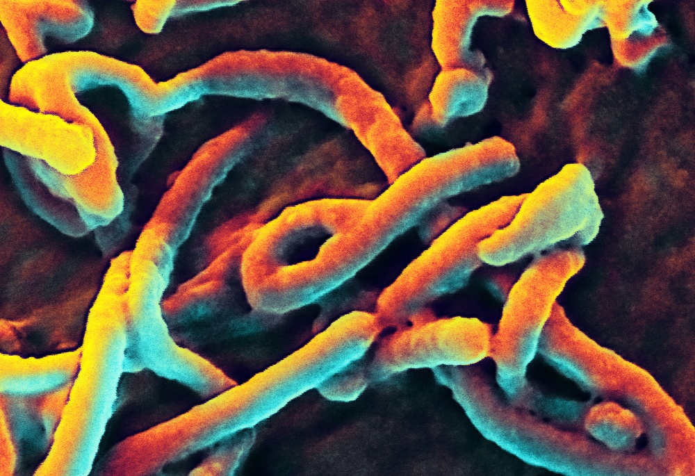 Ebola Virus Budding from Vero Cell Surface