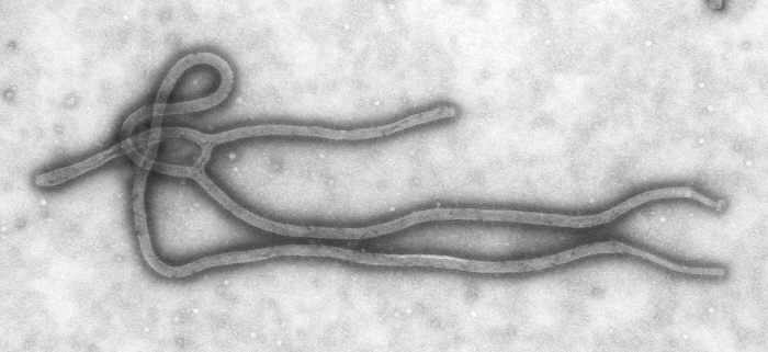 Ebola Virus Virion Structure Revealed in Electron Micrograph