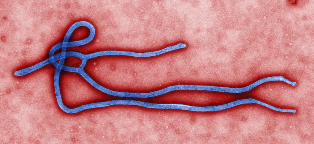 Ebola Virus Morphology Revealed in Electron Micrograph