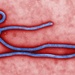 Ebola Virus Morphology Revealed in Electron Micrograph
