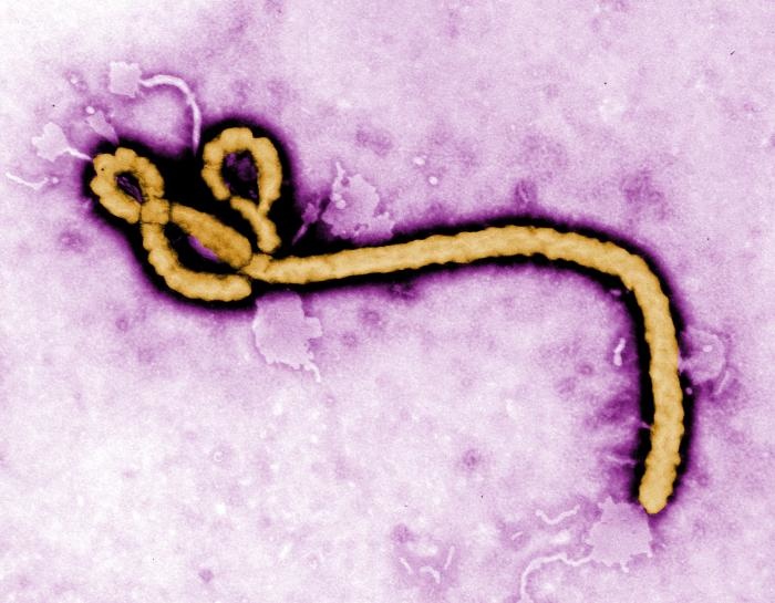 Colorized Electron Micrograph Reveals Ebola Virus Ultrastructure