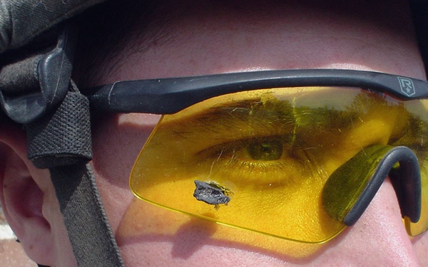 Eye Injuries Avoidable, Doctor Says