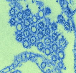 Pandemic Potential: H1N1 Flu Virus Particles Detected in 2009 Outbreak