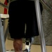 New Prosthetic Ankle and Foot Combination Allows Foot Flexion