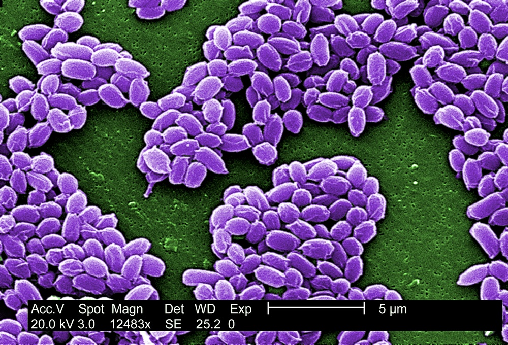 Anthrax Spores Revealed Under Electron Microscope