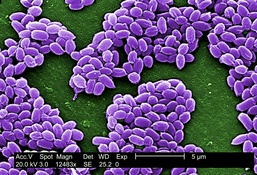 Anthrax Spores Revealed Under Electron Microscope