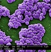 Anthrax Spores Revealed Under Electron Microscope