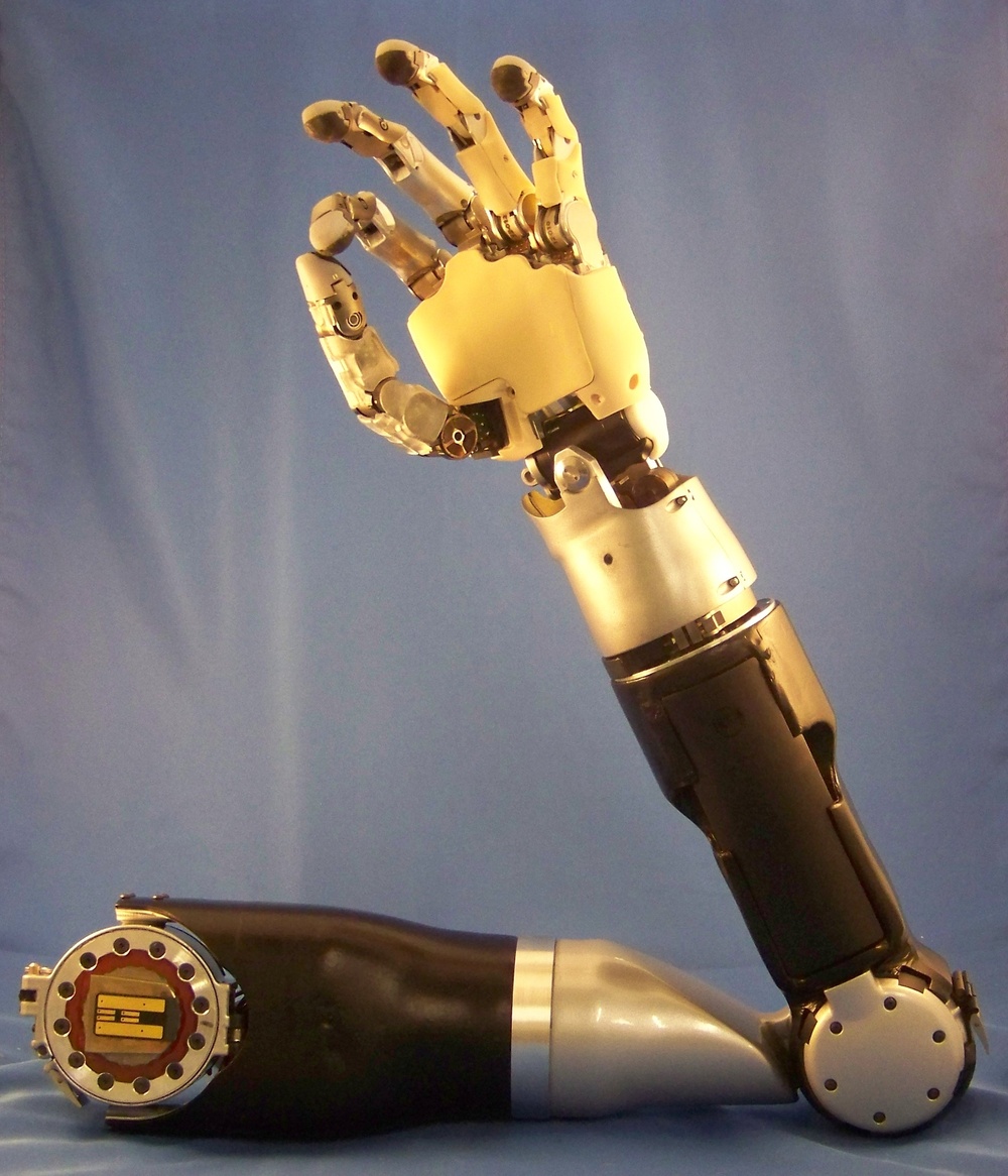Cutting-Edge Prosthetic Limb Offers Unprecedented Control