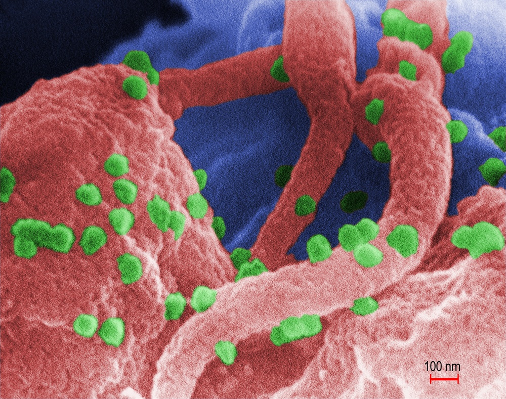 HIV Particles Infect Immune Cell in Striking Micrograph