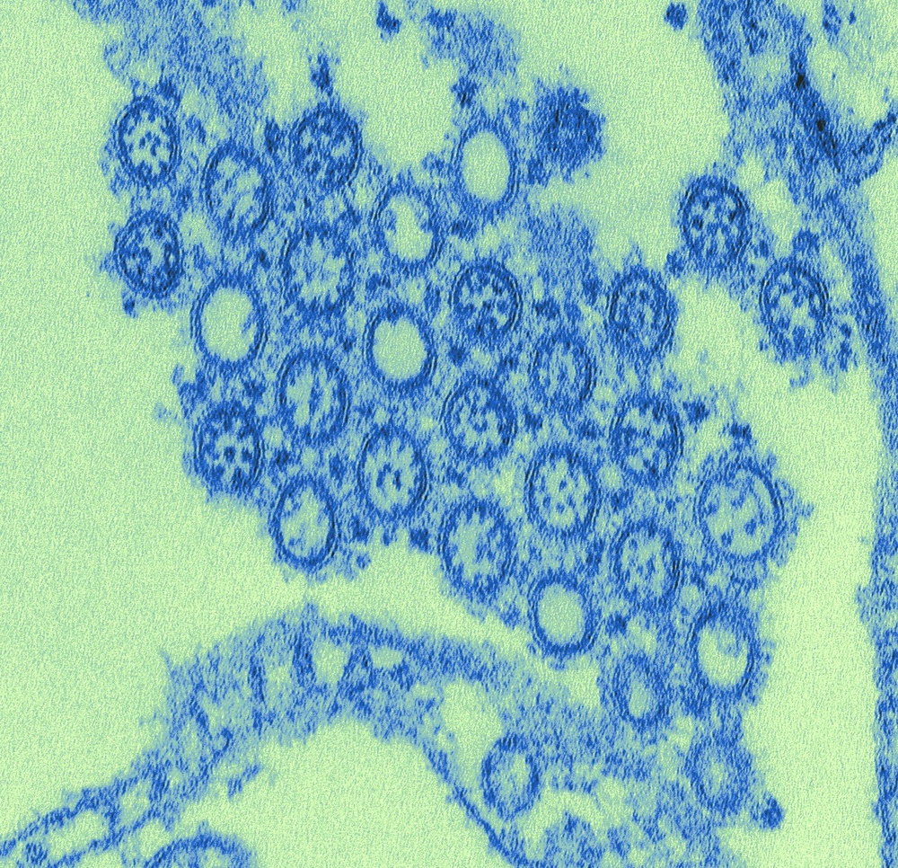Pandemic H1N1 Virus Particles Revealed in Striking Micrograph