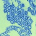 Pandemic H1N1 Virus Particles Revealed in Striking Micrograph