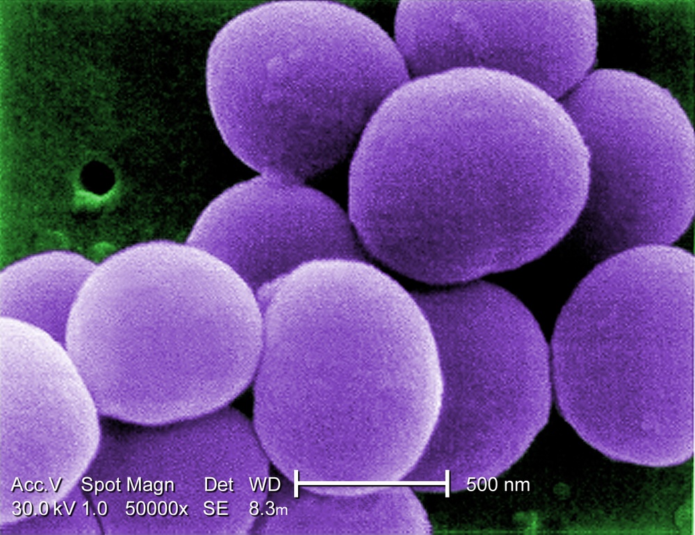 Deadly Superbug: Magnified View of Antibiotic-Resistant Staph Bacteria