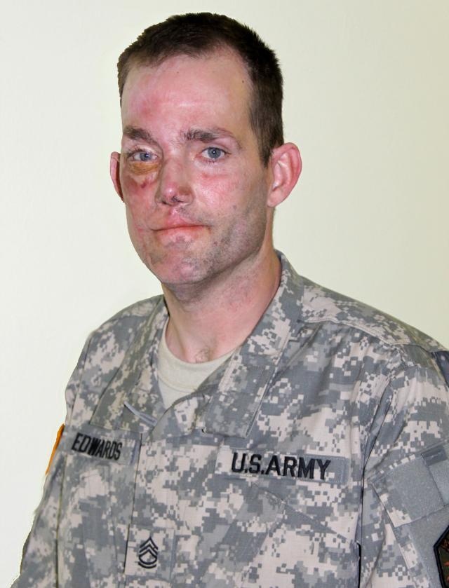 Wounded Warrior Sgt. 1st Class Chris Edwards Continues to Lead Soldiers in Germany