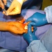 Army Surgeon Performs Life-Changing Skin Graft for Afghan Man