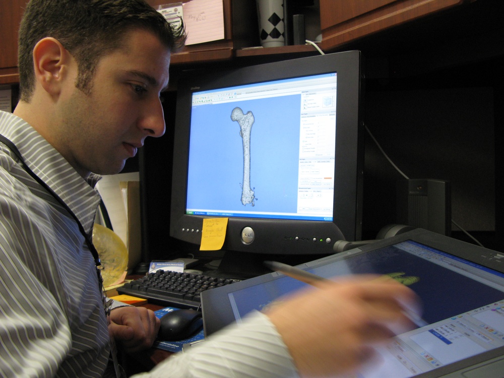 3-D Printed Medical Models Help Surgeons Prepare for Complex Procedures