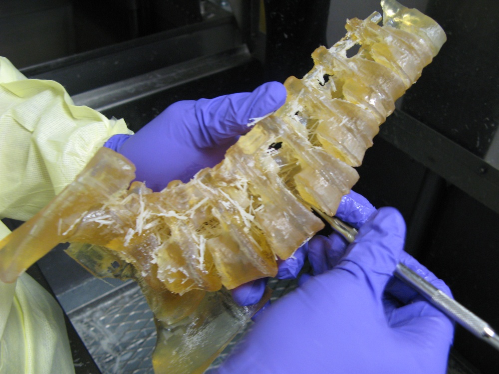 3D Printing Revolutionizes Spinal Surgery at Walter Reed