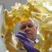 3-D Imaging Helps Surgeons Tackle Challenging Bone Growth in Amputees