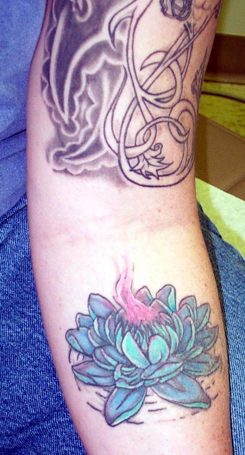 Navy Petty Officer's Tattoos Removed with Laser Treatment