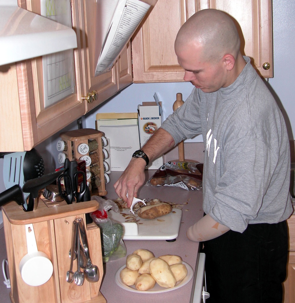 Injured Soldier Perseveres, Peels Potatoes with One Hand