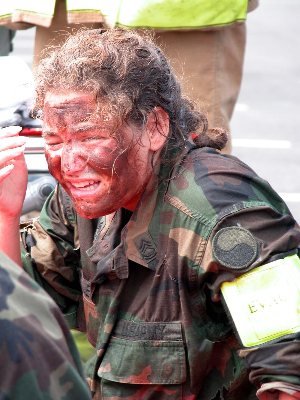 Simulated Burn Victim Awaits Evacuation During Pentagon Exercise