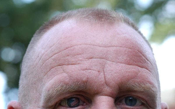 Patriotic Soldier Displays Flag in Prosthetic Eye