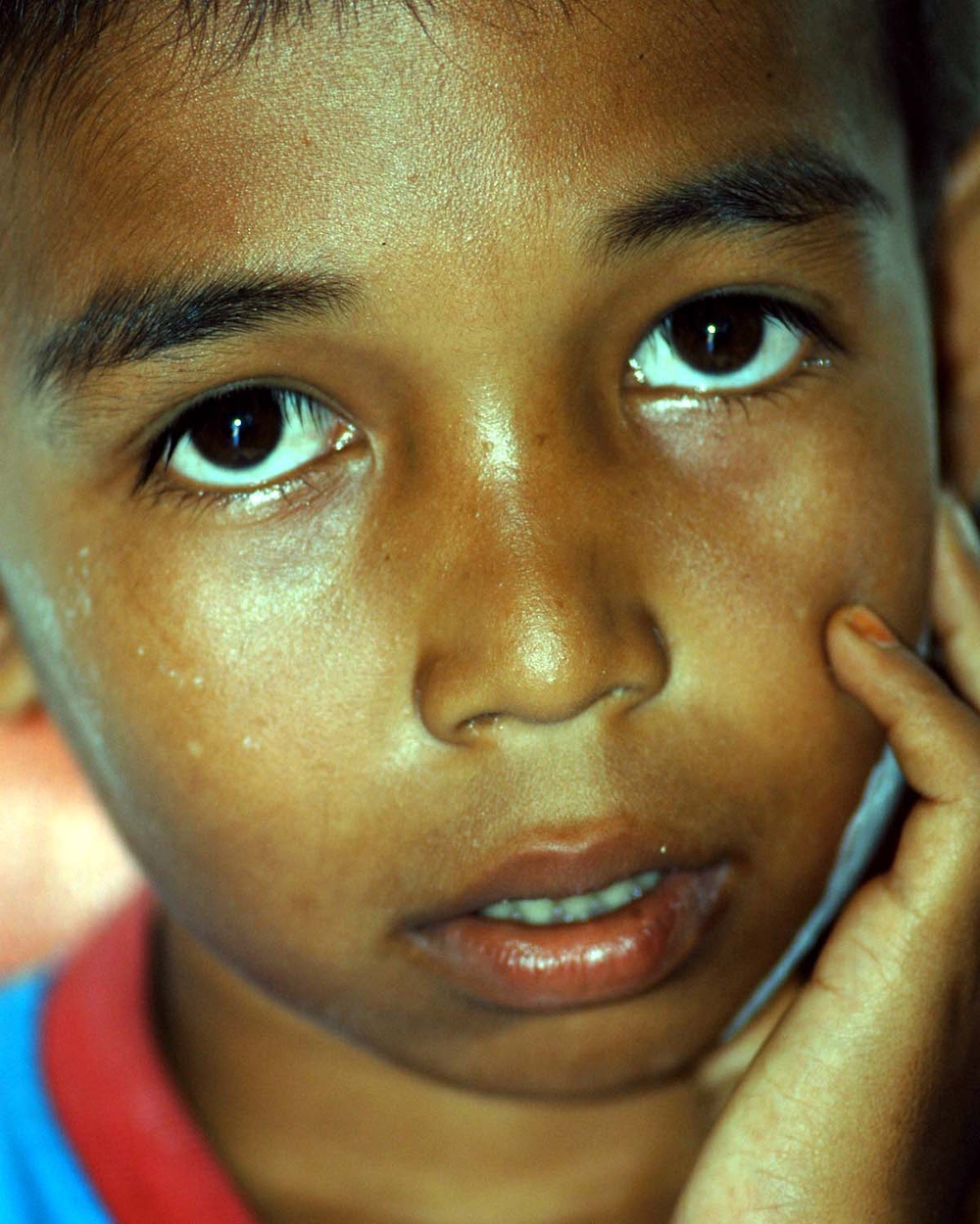 Indonesian Boy Receives Dental Care, Avoids Tooth Extraction