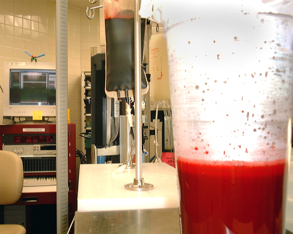 Hemoglobin-Based Oxygen Carriers Offer Lifesaving Bridge Until Real Blood Available