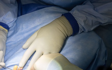 CP25 Syndactyly Surgery Ecuador