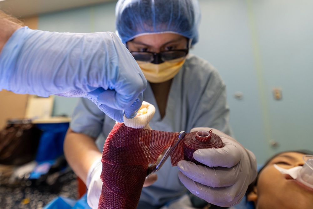 CP25 Syndactyly Surgery Ecuador